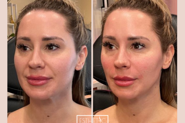 1_20250103_035526_0000 1_20250103_035526_0000