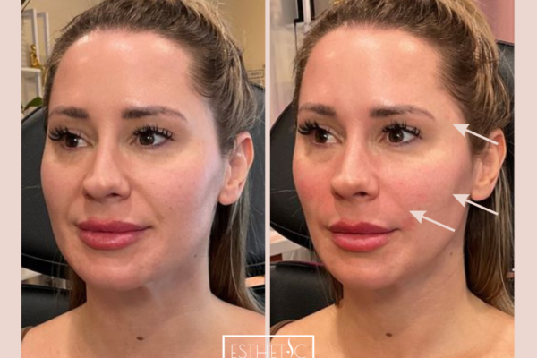 2_20250103_035526_0001 2_20250103_035526_0001