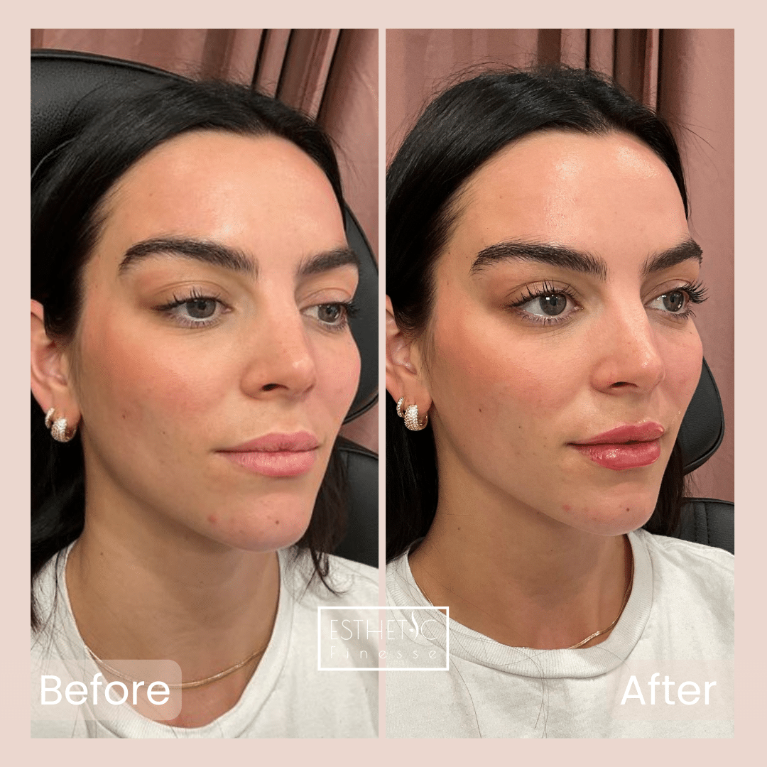 2_20250103_040241_0001