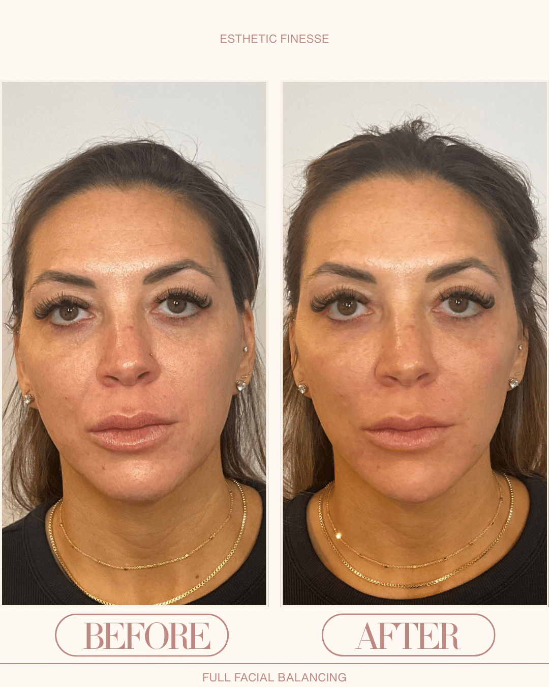 scottsdale facial balancing results