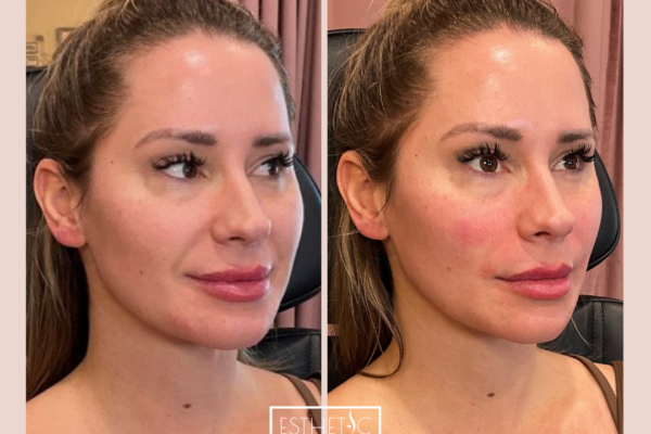 4_20250103_035526_0003 4_20250103_035526_0003