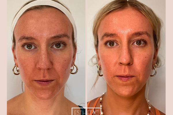 Amanda Yeakle's Sculpta Healed_20250103_035638_0000 Amanda Yeakle's Sculpta Healed_20250103_035638_0000