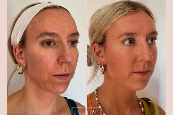 Amanda Yeakle's Sculpta Healed_20250103_035638_0001 Amanda Yeakle's Sculpta Healed_20250103_035638_0001