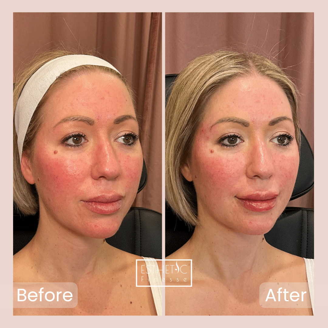 Lauren Janiec's Lip Maintainence and Temple_20250103_040427_0002